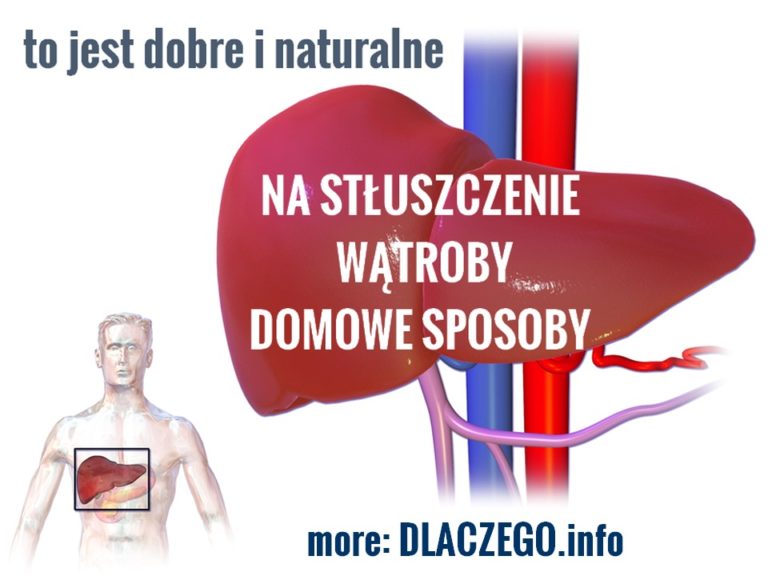 StŁuszczenie WĄtroby Leczenie Naturalne Czyli Co Pomaga Na Wątrobę 5 Sposobów 1387